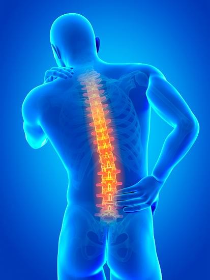Back Pain Relief in 30 Days: The Complete Blueprint